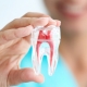 La endodoncia y su importancia