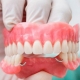 La importancia de una prótesis dental
